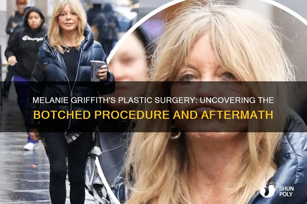 who botched melanie griffiths plastic surgery