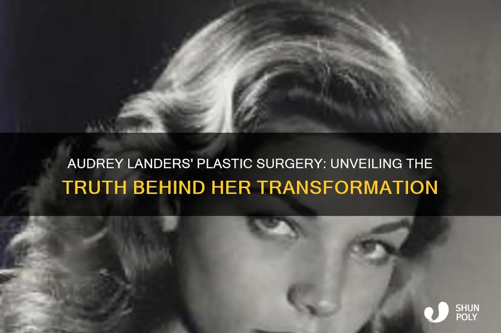 who did audrey landers plastic surgery