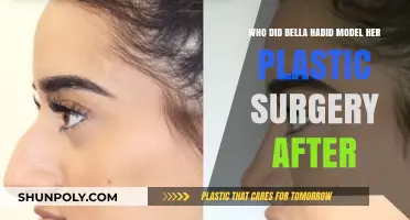 Bella Hadid's Plastic Surgery Inspiration: Unveiling Her Transformation Role Model