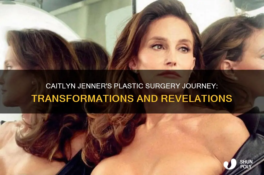 who did caitlyn jenner plastic surgery