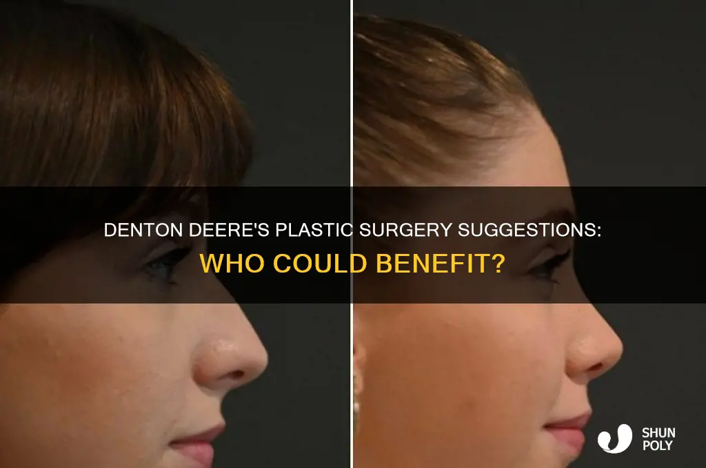 who did denton deere suggest could use plastic surgery