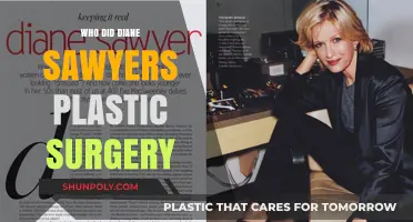 Diane Sawyer's Plastic Surgery: Unveiling the Truth Behind Her Transformation
