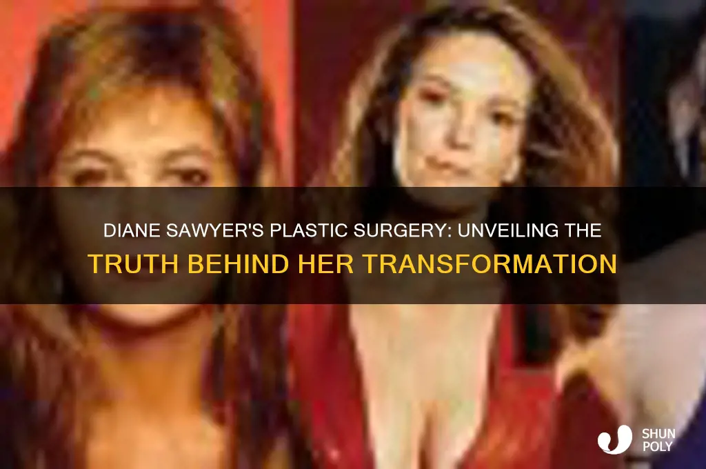 who did diane sawyers plastic surgery