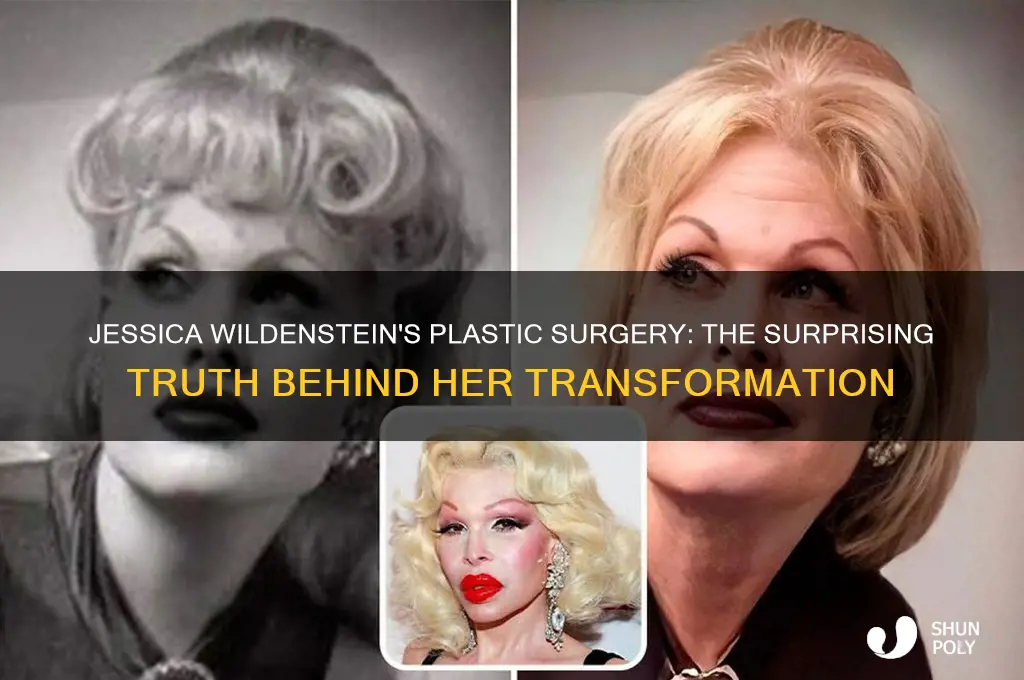 who did jessica wildensteins plastic surgery