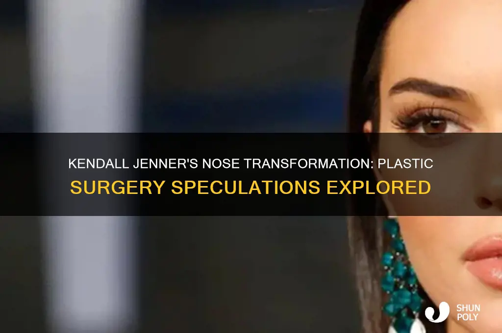 who did kendall jenner nose plastic surgery