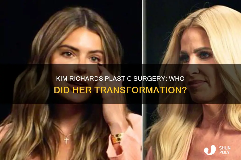 who did kim richards plastic surgery