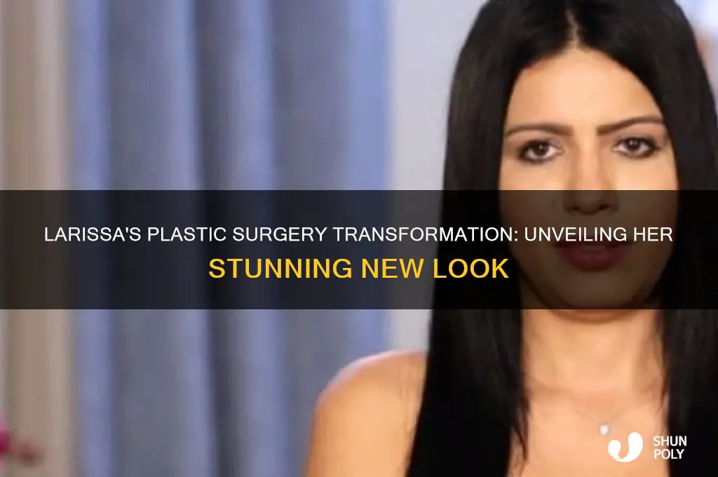 who did larissa plastic surgery