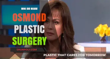 Marie Osmond's Plastic Surgery: Unveiling Her Transformation Journey