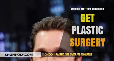 Matthew McGogney's Plastic Surgery: Unveiling the Truth Behind His Transformation
