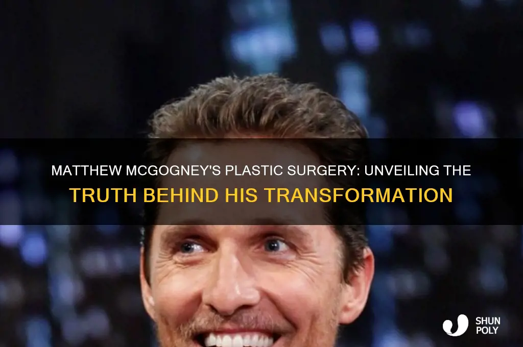 who did matthew mcgogney get plastic surgery