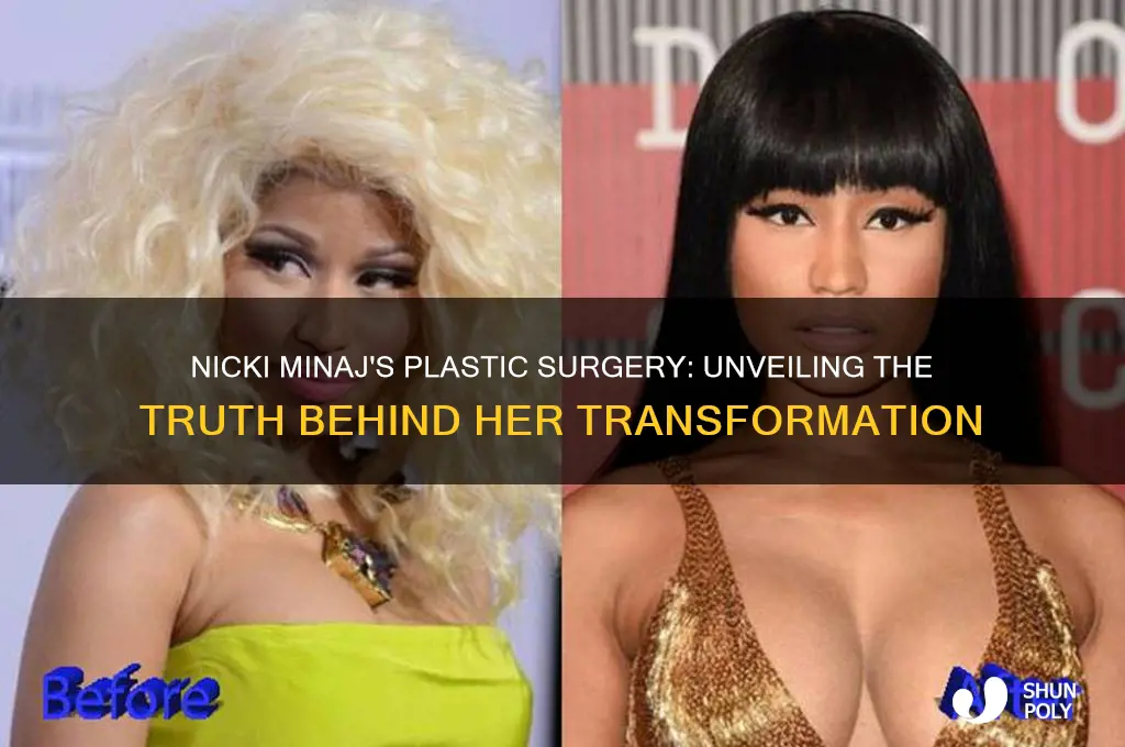 who did nicki minaj plastic surgery