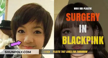 Blackpink Members' Plastic Surgery: Rumors, Facts, and Transformations