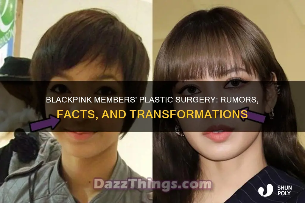 who did plastic surgery in blackpink