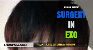 EXO Members' Plastic Surgery: Unveiling the Truth Behind the Rumors