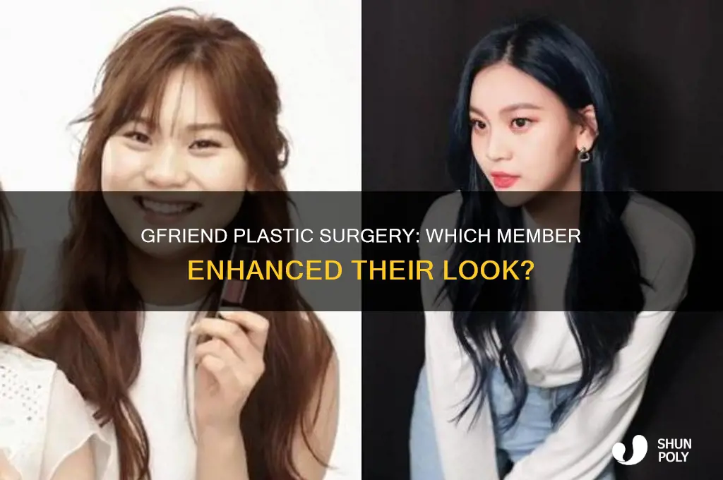 who did plastic surgery in gfriend
