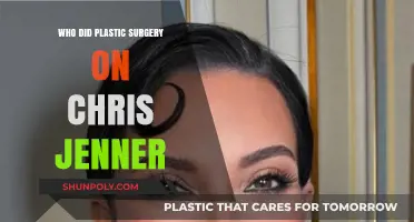 Chris Jenner's Plastic Surgery: The Surgeon Behind Her Transformation