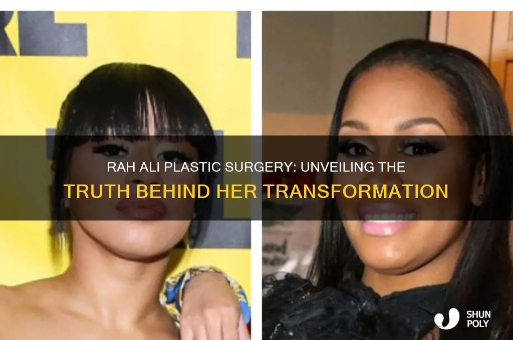 who did rah ali plastic surgery