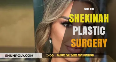 Shekinah's Plastic Surgery Transformation: Unveiling Her Stunning New Look