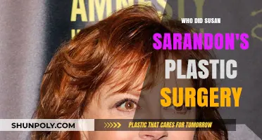 Susan Sarandon's Plastic Surgery: Unveiling the Truth Behind Her Transformation