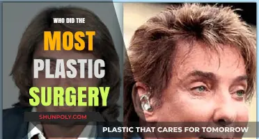 Unveiling the Most Transformed: Celebrities with Extensive Plastic Surgery