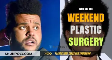 The Weeknd's Transformation: Unveiling the Truth Behind His Plastic Surgery