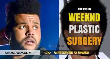 The Weeknd's Plastic Surgery: Unveiling the Truth Behind His Transformation