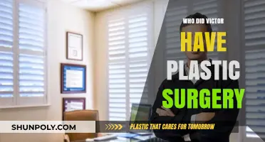 Who Did Victor Have Plastic Surgery? Unveiling the Truth Behind the Transformation