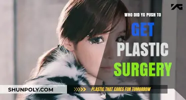 YG Entertainment's Alleged Pressure: Who Underwent Plastic Surgery?