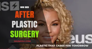 Tragic Endings: Celebrities Who Died After Plastic Surgery