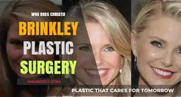 Christie Brinkley's Plastic Surgery: Unveiling Her Timeless Beauty Secrets