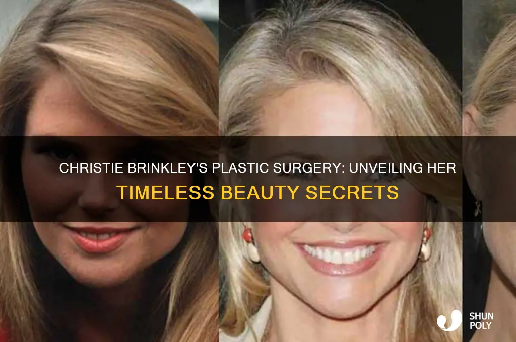 who does christie brinkley plastic surgery