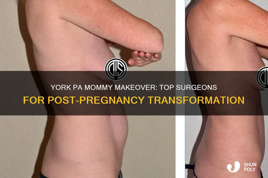 who does the mommy makeover plastic surgery arpund york pa