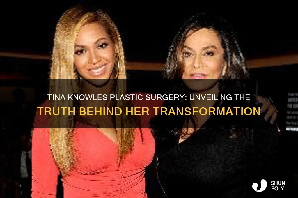 who does tina knowles plastic surgery