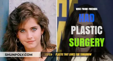 Friends Stars' Plastic Surgery: Who Had Work Done?