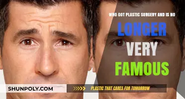 Fading Stars: Celebrities Who Got Plastic Surgery and Lost Fame