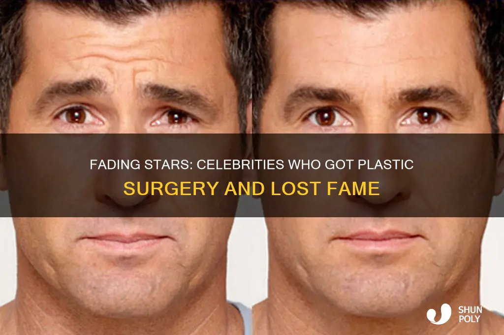 who got plastic surgery and is no longer very famous