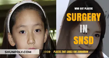 SNSD Plastic Surgery: Unveiling the Truth Behind the Girls' Generation Transformations
