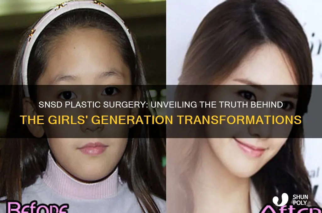 who got plastic surgery in snsd