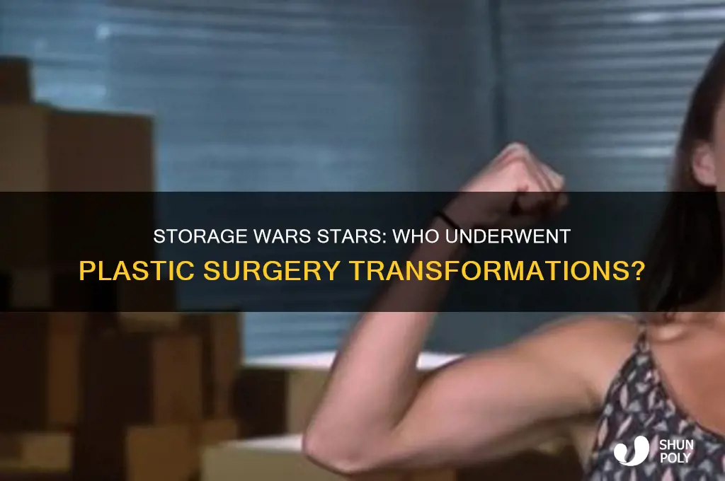 who got plastic surgery on storage wars