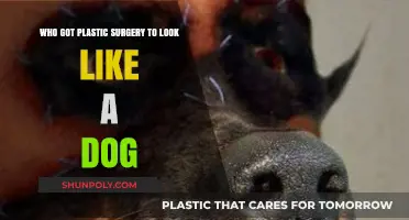Human Transforms into Canine: The Extreme Dog-Like Plastic Surgery Journey