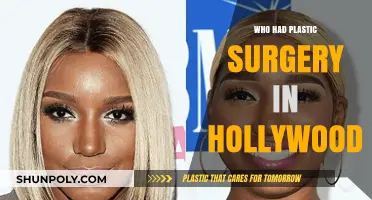 Hollywood's Plastic Surgery Secrets: Stars Who Went Under the Knife