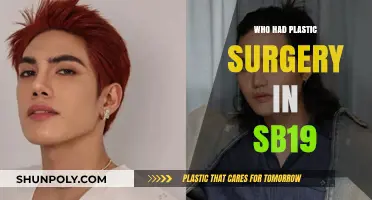 Unveiling SB19's Transformation: Members Who Underwent Plastic Surgery