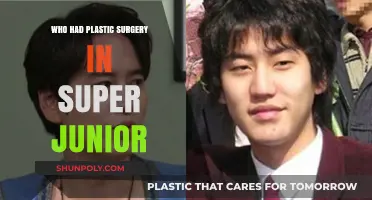 Super Junior Members Who Underwent Plastic Surgery: Revealed