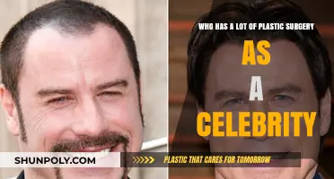 Celebrities Transformed: Who's Had Extensive Plastic Surgery?