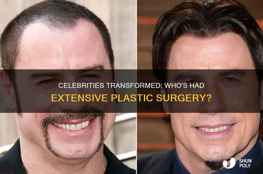 who has a lot of plastic surgery as a celebrity