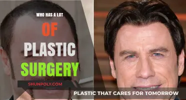 Celebrities and Plastic Surgery: Who's Gone Under the Knife?