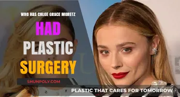 Chloe Grace Moretz Plastic Surgery: Fact-Checking the Rumors and Speculations