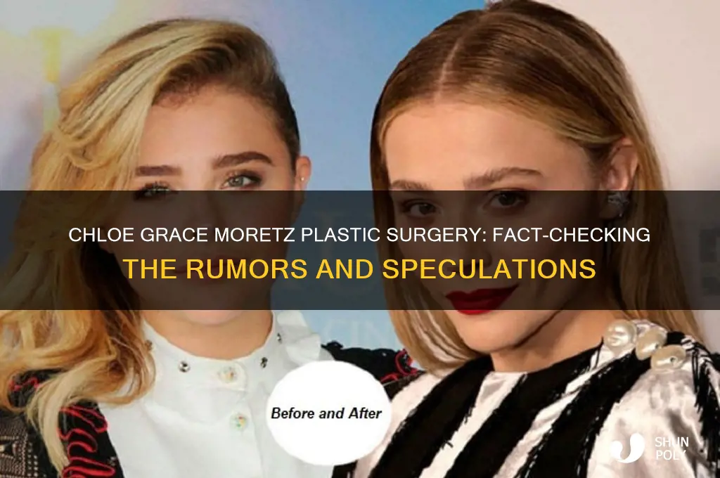 who has chloe grace moretz had plastic surgery