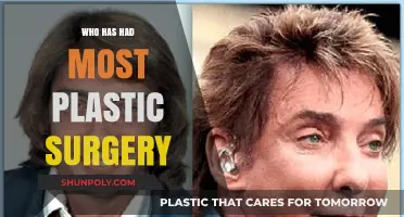 Unveiling the Celebrities with the Most Plastic Surgery Transformations