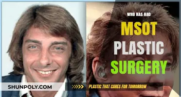 Unveiling the Celebrities with the Most Plastic Surgery Transformations
